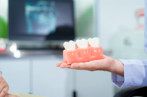 A dentist explaining restorative dental treatment options such as fillings and root canal therapy.