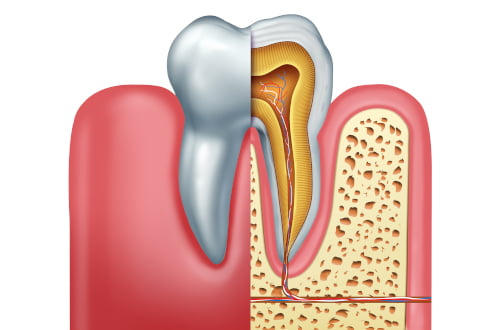 root canal treated tooth longevity crown durability