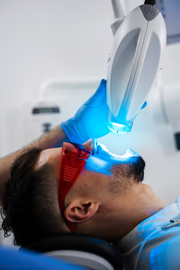 Teeth Whitening Options at Pickering Smile Centre