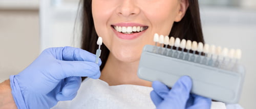 Dentist comparing veneer shade samples to a patient’s teeth during the porcelain veneer treatment process.