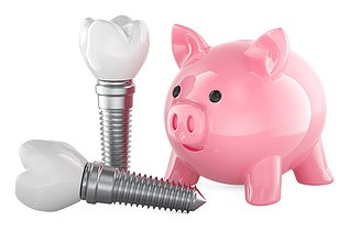 How Much Do Dental Implants Cost in Canada?