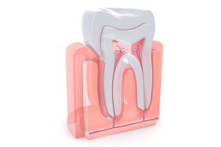 How Much Does a Root Canal Cost in Canada?