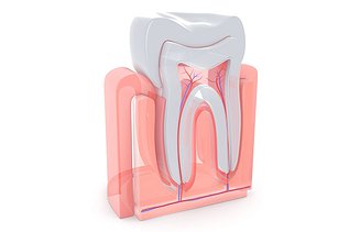 How Much Does a Root Canal Cost in Canada?