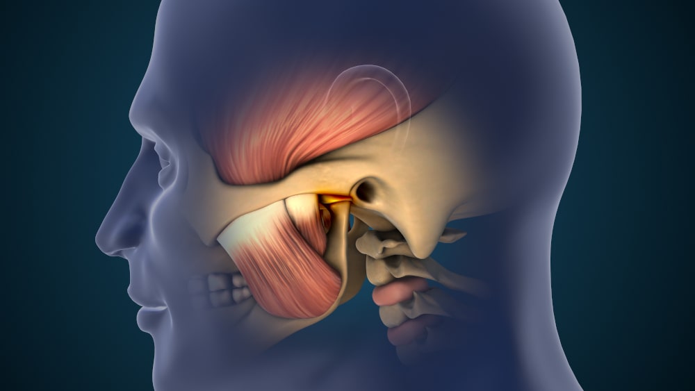 Anatomical rendering of jaw pain caused by TMJ disorder